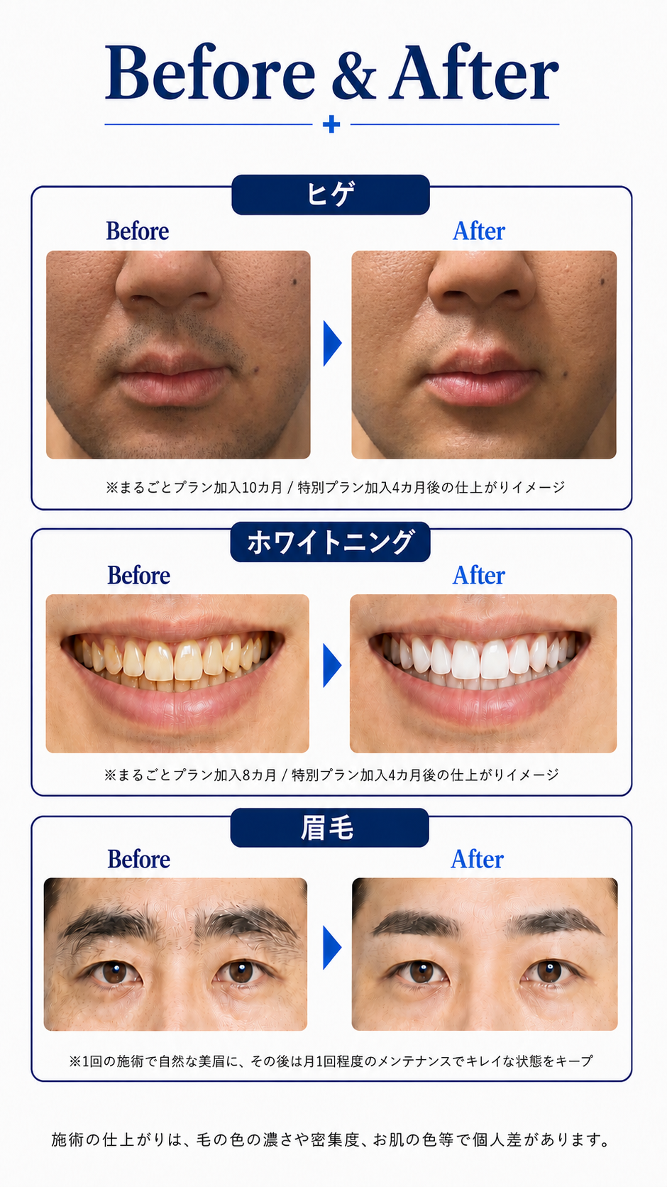 ヒゲ、ホワイトニング、眉毛のBefore and After。施術の仕上がりは個人差があります。
